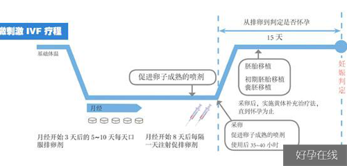 试管微刺激方案