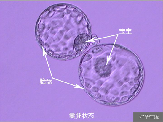 冷冻胚胎