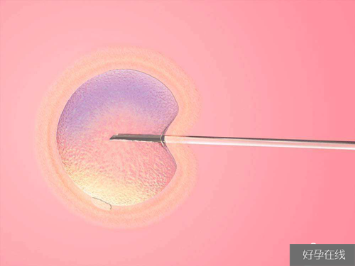 囊胚移植