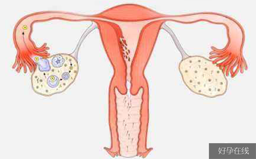 辅酶Q10对卵巢的作用