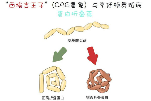 亨廷顿舞蹈症致病机理