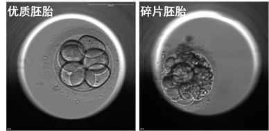 图4 - 优质胚胎与碎片胚胎