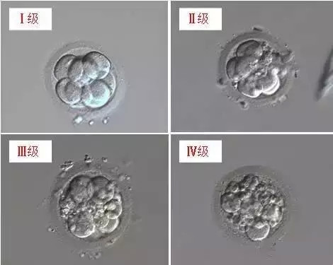 胚胎主要分为4个等级